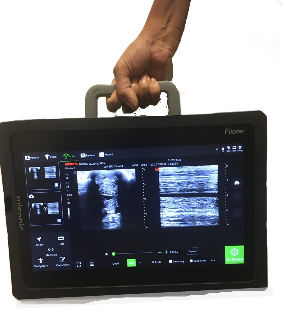 Piloter Reproductions and Tendon scanner portable