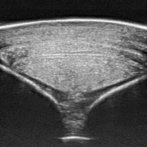 Equine Tendon