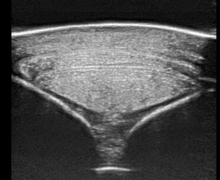Equine Tendon
