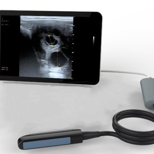 Light weight Reproduction Scanner